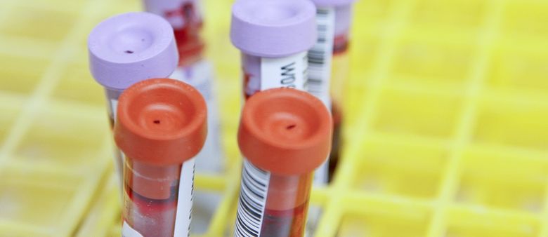 Češi investují do nizozemského projektu, který vyvíjí technologii pro testování krevní srážlivosti. Fond i&i Bio poslal více než milion eur