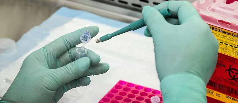Sensible Biotechnologies vybrala v Pre-seed kole 4,2 milionu dolarů